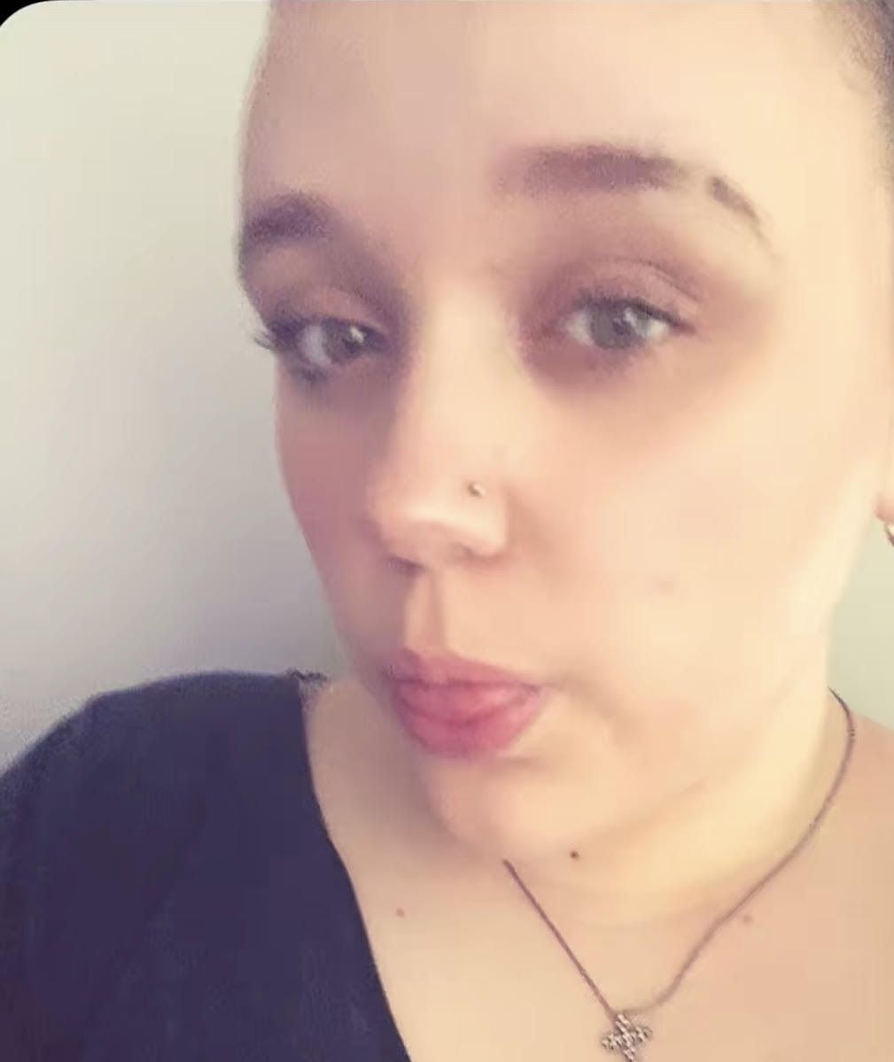 Read more about the article Video: Kylee had bruises in April?